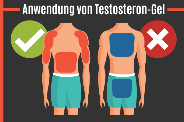 Anwendung von Testosteron-Gel