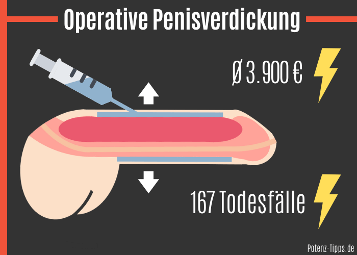 Operative Penisverdickung