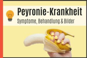 Peyronie-Krankheit - Symptome, Behandlung und Bilder