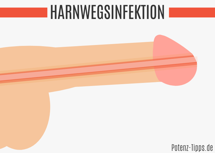 Harnwegsinfektion