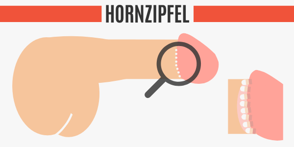 Hornzipfel