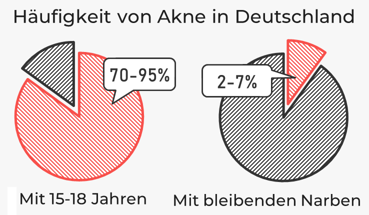 Häufigkeit von Akne in Deutschland