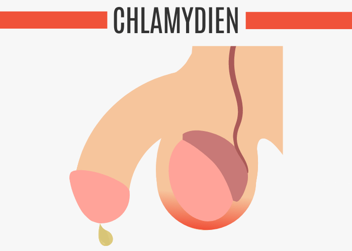 Chlamydien