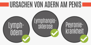 Adern Am Penis 8 Ursachen F r Sichtbare Venen 2026 Potenz Tipps adern-am-penis-8-ursachen-f-r-sichtbare-venen-2026-potenz-tipps