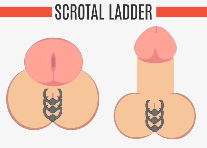 Scrotal Ladder