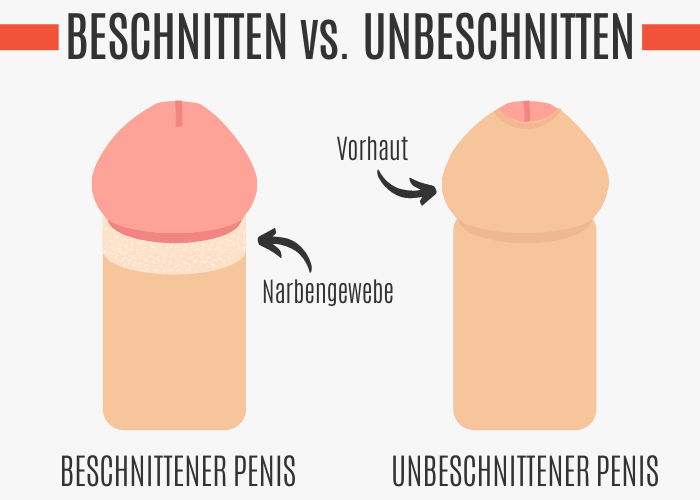 Beschnittener Penis vs. unbeschnittener Penis