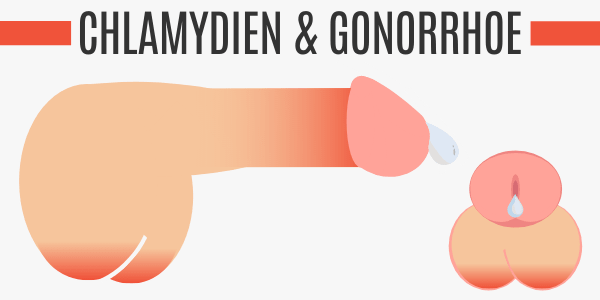 Chlamydien & Gonorrhoe