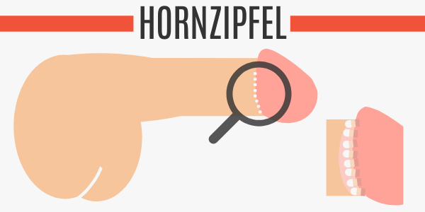 Hornzipfel
