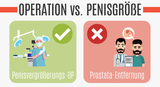 Operation vs. Penisgröße