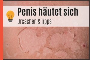 Penis häutet sich - Ursachen & Tipps