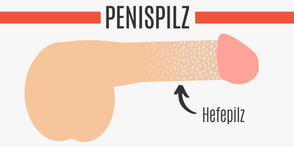 Am penis pilz Penispilz →