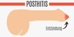 geschwollener penis 11 ursachen bilder 2024 potenz tipps für