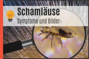 Schamläuse - Symptome und Bilder